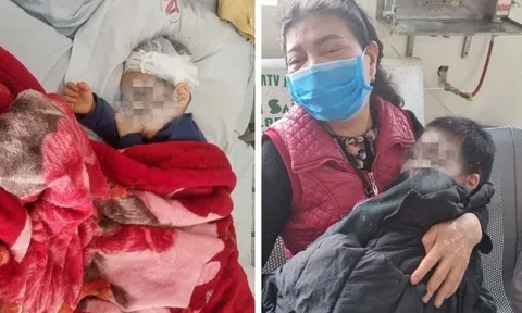 2 cháu bé chưa hết hoảng loạn sau vụ chó dữ tấn công lúc đi chơi cùng bố