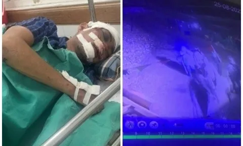 Truy bắt nhóm đối tượng đánh trọng thương 5 công nhân mỏ vàng